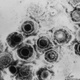 Illustration for article titled New Class of Drug Shows Promise in the Treatment of Herpes